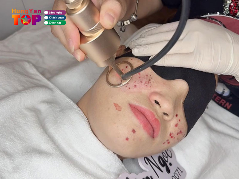 Kim-ngoc-beauty-spa-hungyentoplist