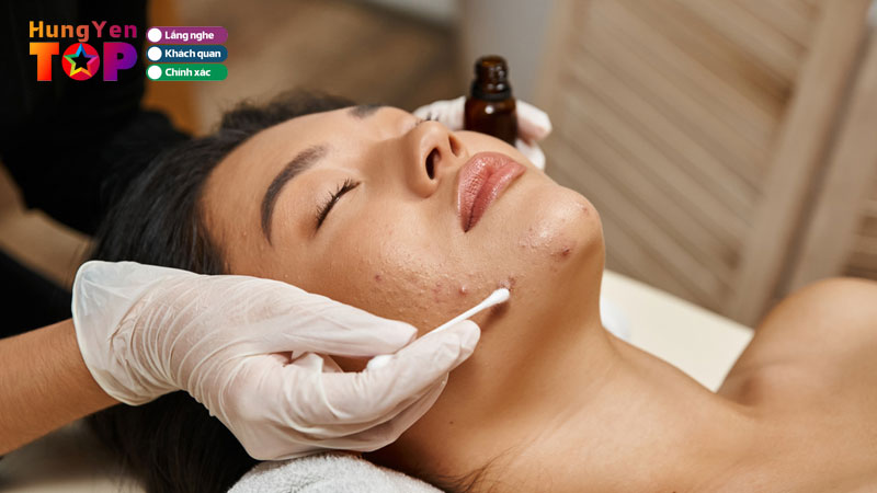 Top-10-dia-chi-tri-mun-tai-hung-yen-an-toan-tan-goc-hungyentoplist