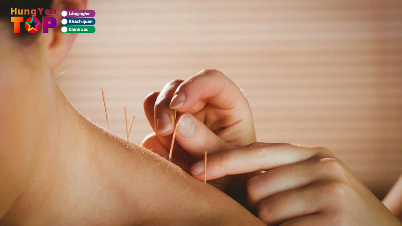 Top-5-dia-chi-cham-cuu-tai-hung-yen-uy-tin-hieu-qua-hungyentoplist